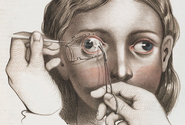 閲覧注意 19世紀ヨーロッパで実際に行われていた外科手術のイラスト集 Crucial Interventions Dna